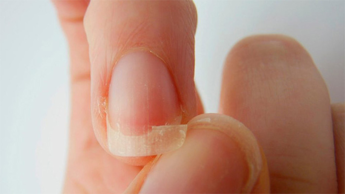 blackmores hair skin nails 60 vien cua uc vitamin cho toc mong va da anh 3